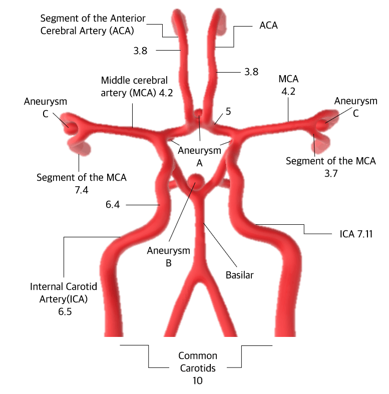 VasculiX_Neuro 뇌혈관 구조 다이어그램 — 총경동맥, 내경동맥, 중대뇌동맥, 전대뇌동맥, 뇌동맥류 각 부위별 직경 표기